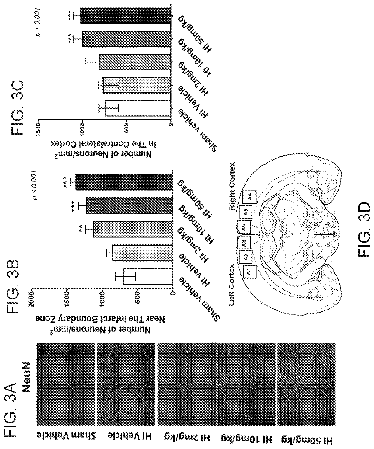 Phosphodiesterase inhibitors to repair brain and/or retinal injury in human newborns