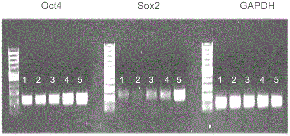 Dendritic cell vaccine and preparation method and application of dendritic cell vaccine