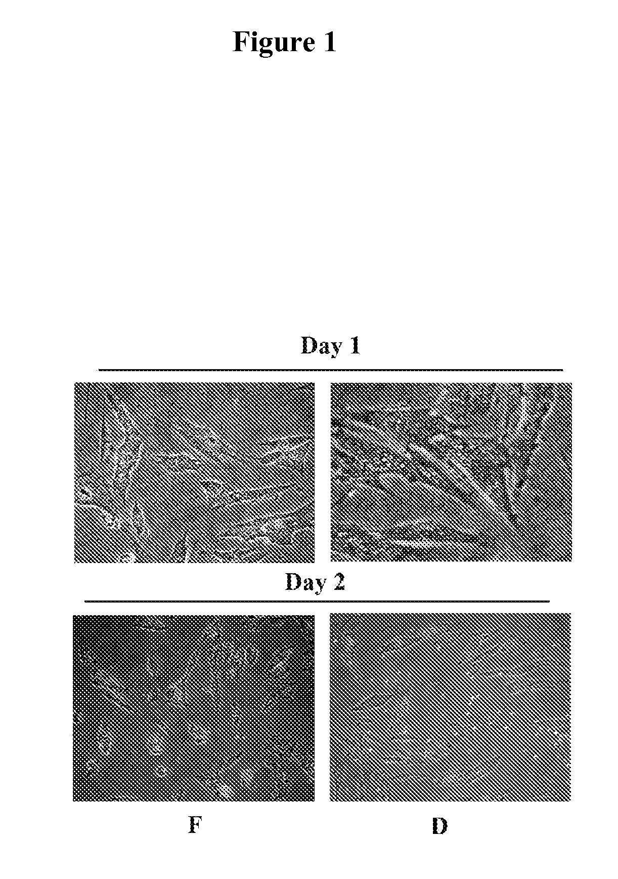 Method and composition for restoration of age-related tissue loss in the face or selected areas of the body