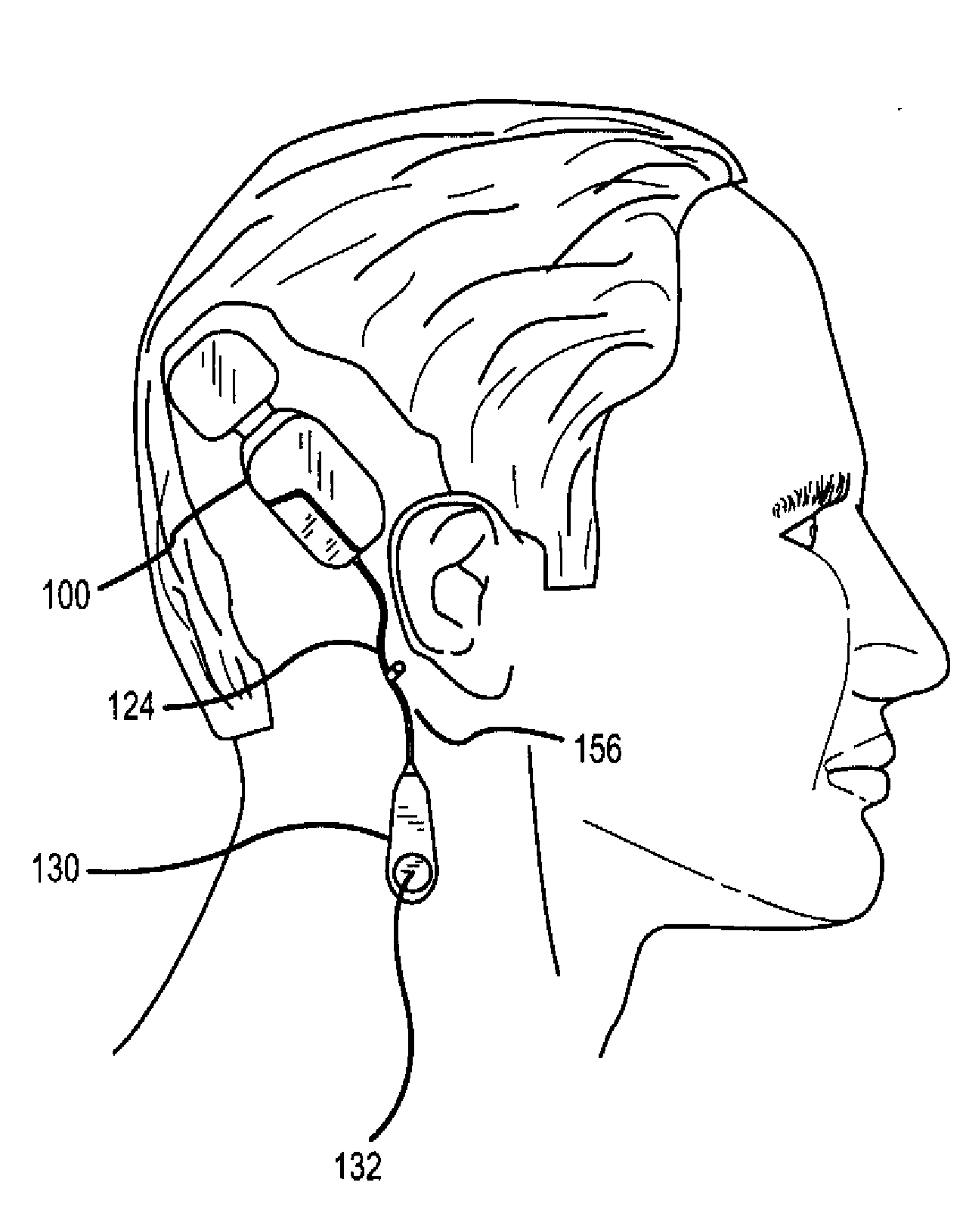 Systems and methods for securing subcutaneous implanted devices