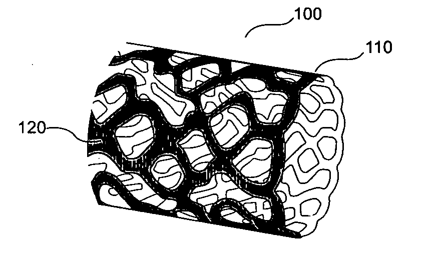 Surgical stent having micro-geometric patterned surface