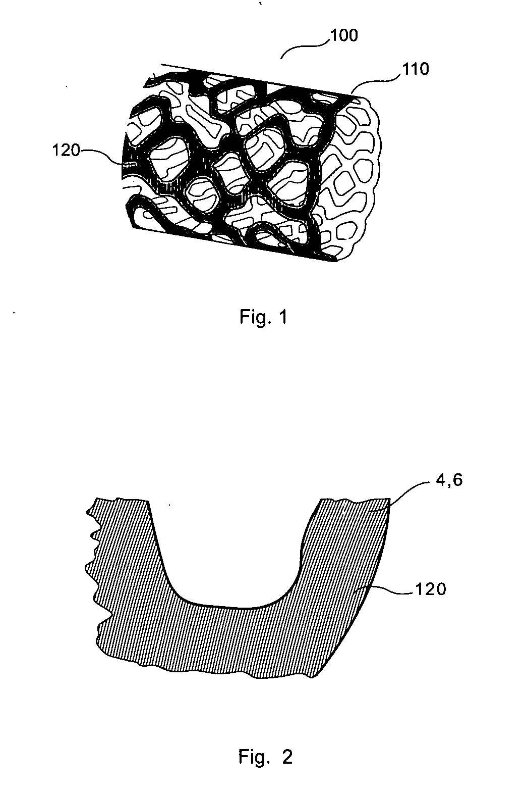 Surgical stent having micro-geometric patterned surface