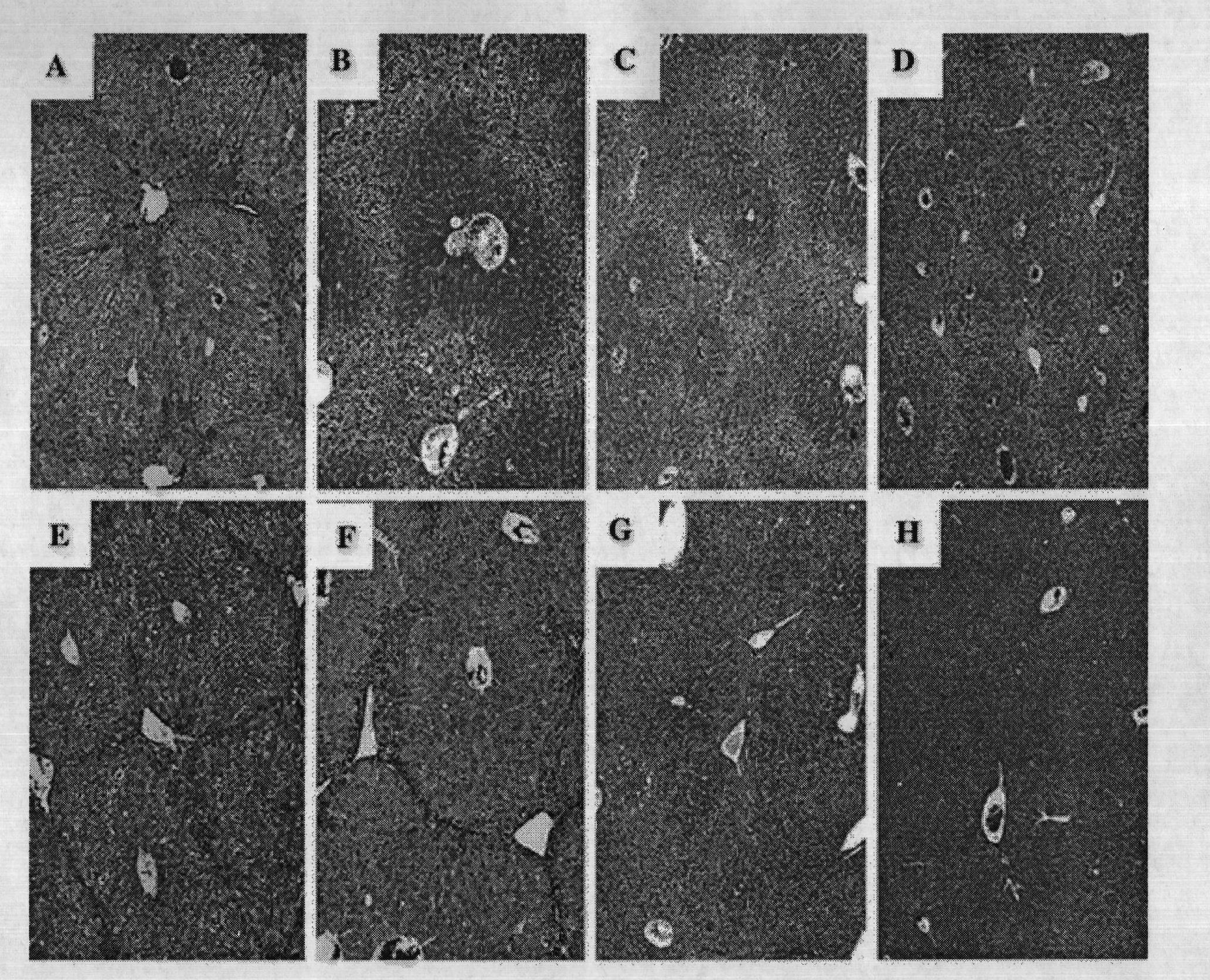 Construction method for oriented gene transfer vector in compound type liver