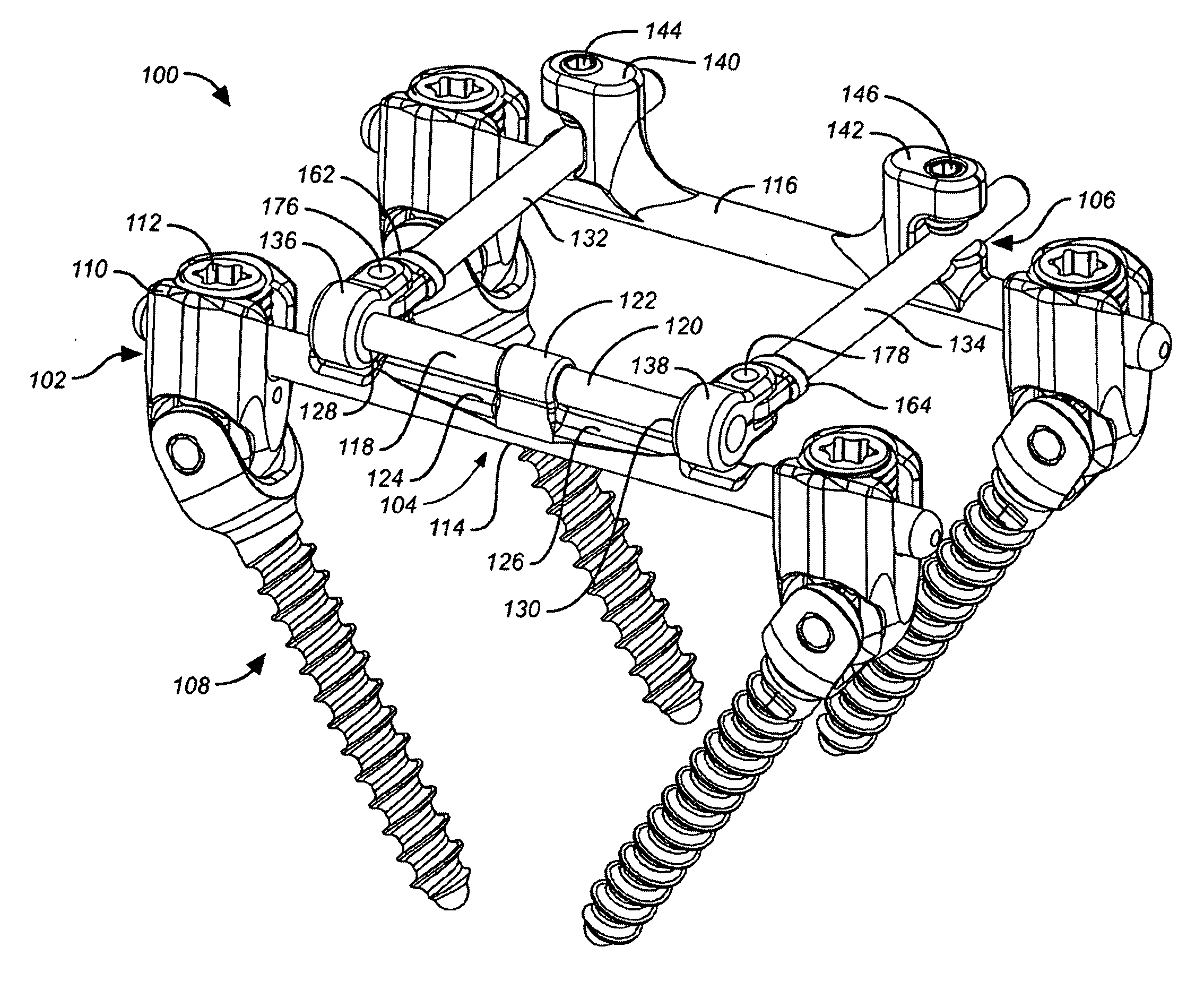 Deflection rod system dimensioned for deflection to a load characteristic for dynamic stabilization and motion preservation spinal implantation system and method