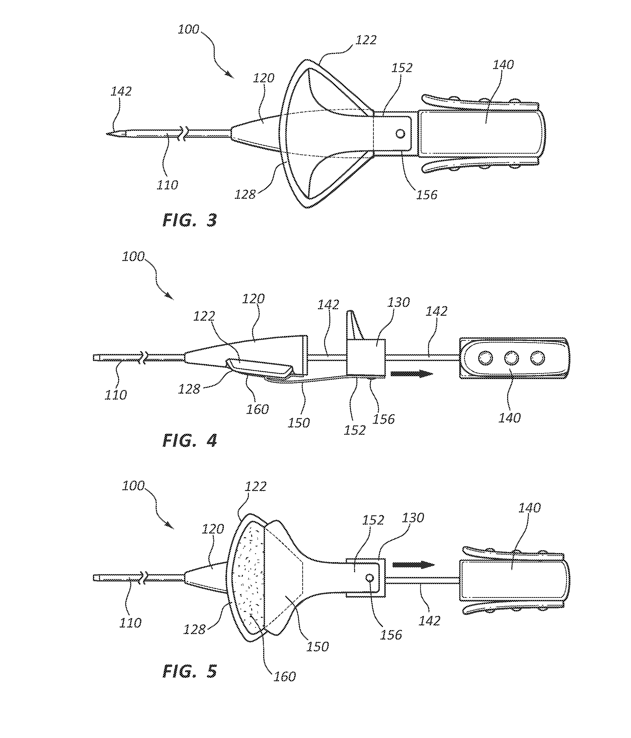 Adhesive backed IV catheter with auto release liner