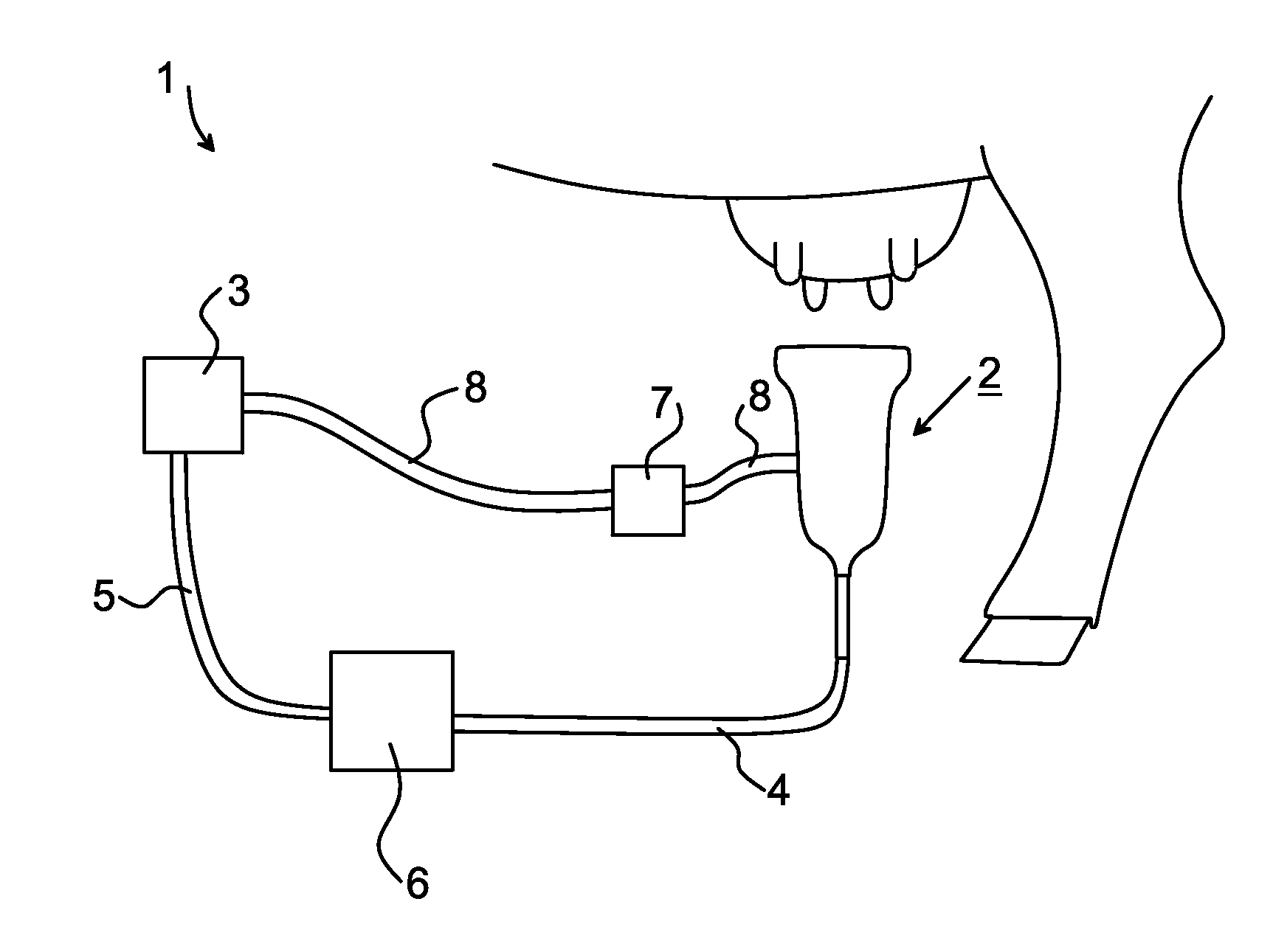Milking system, a teat cup and a teat cup liner