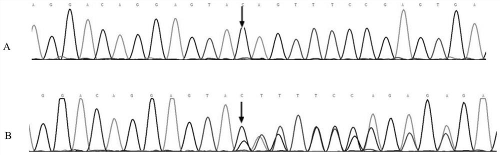 New Mutant Proteins and New Mutant Genes Associated with Dilated Cardiomyopathy and Their Applications