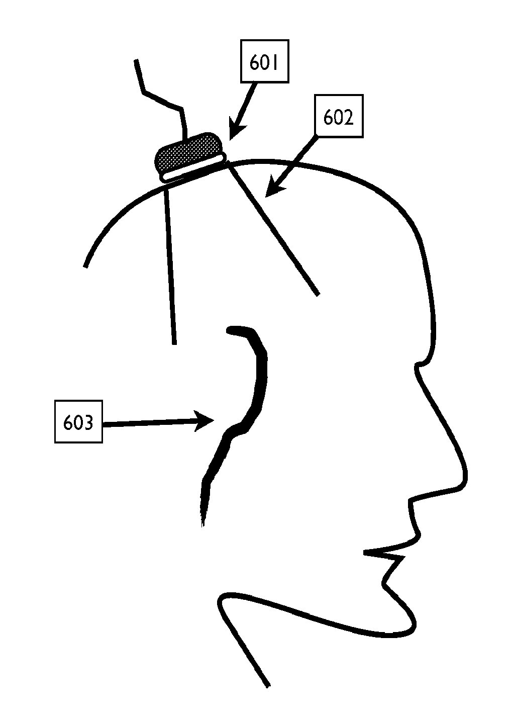 Device and Methods for Targeting of Transcranial Ultrasound Neuromodulation by Automated Transcranial Doppler Imaging