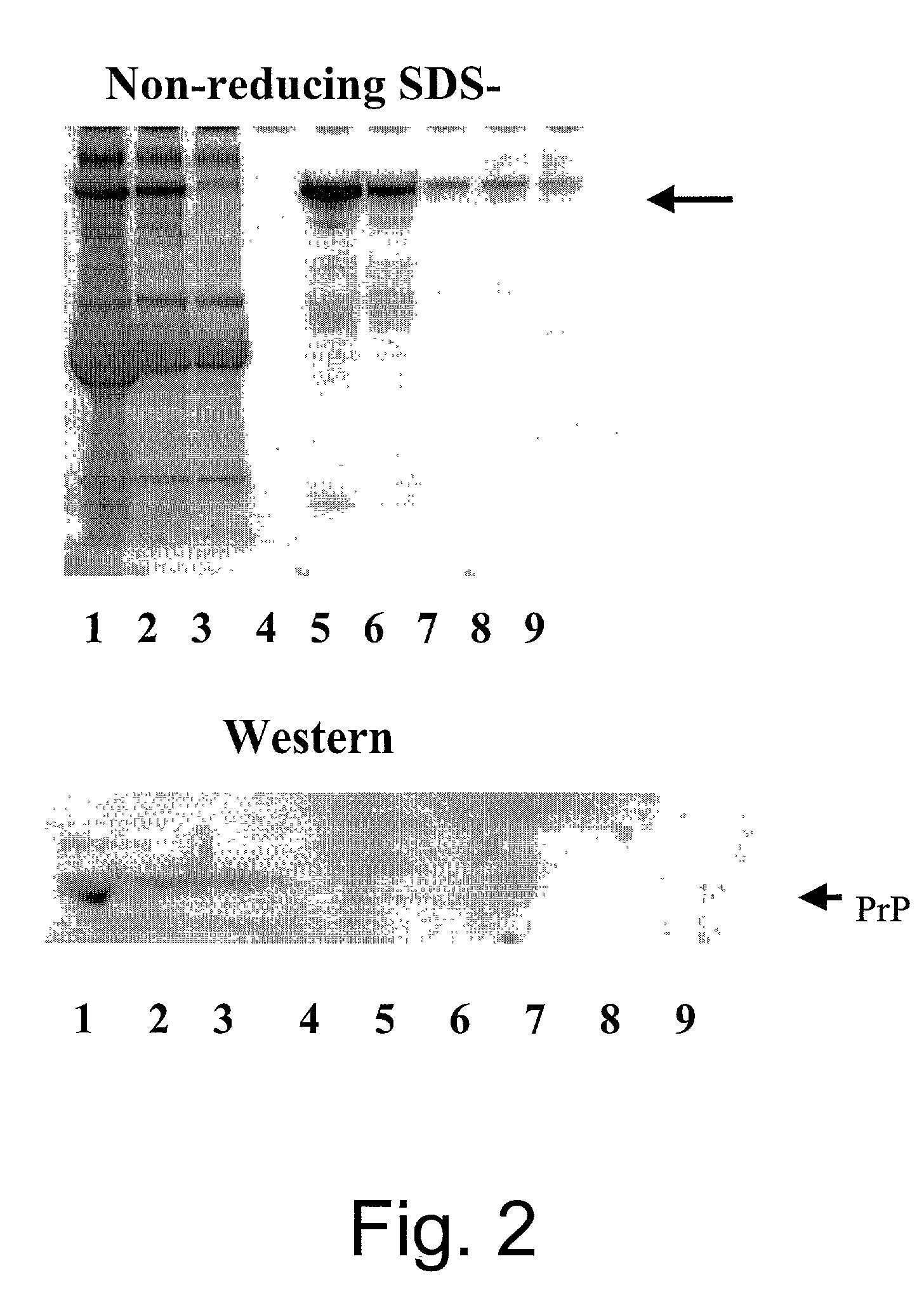 Apparatus and method for separation of biological contaminants