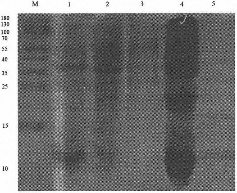 Preparation method and application of ferroferric oxide brain-targeted contrast agent