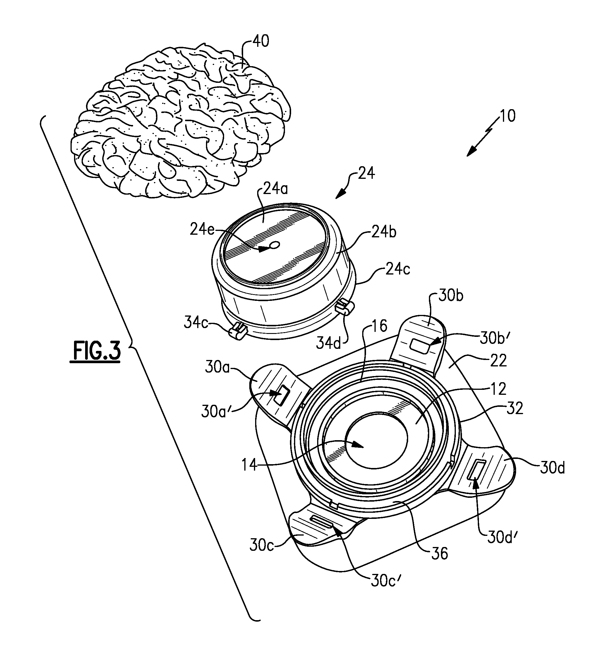 Ostomy Appliance and Method