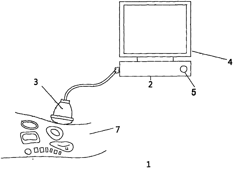 Ultrasonic detector