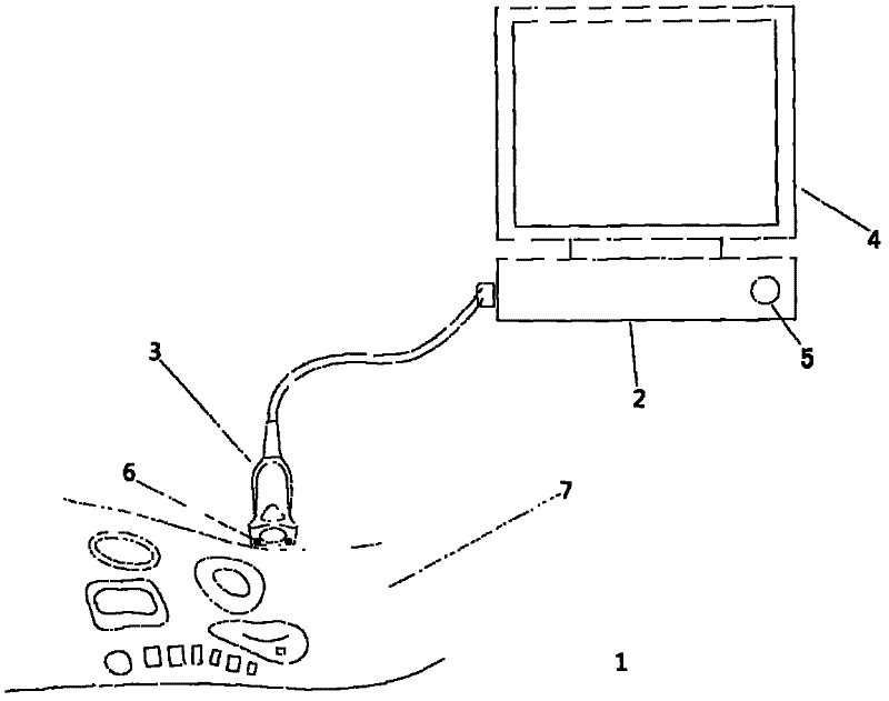 Ultrasonic detector