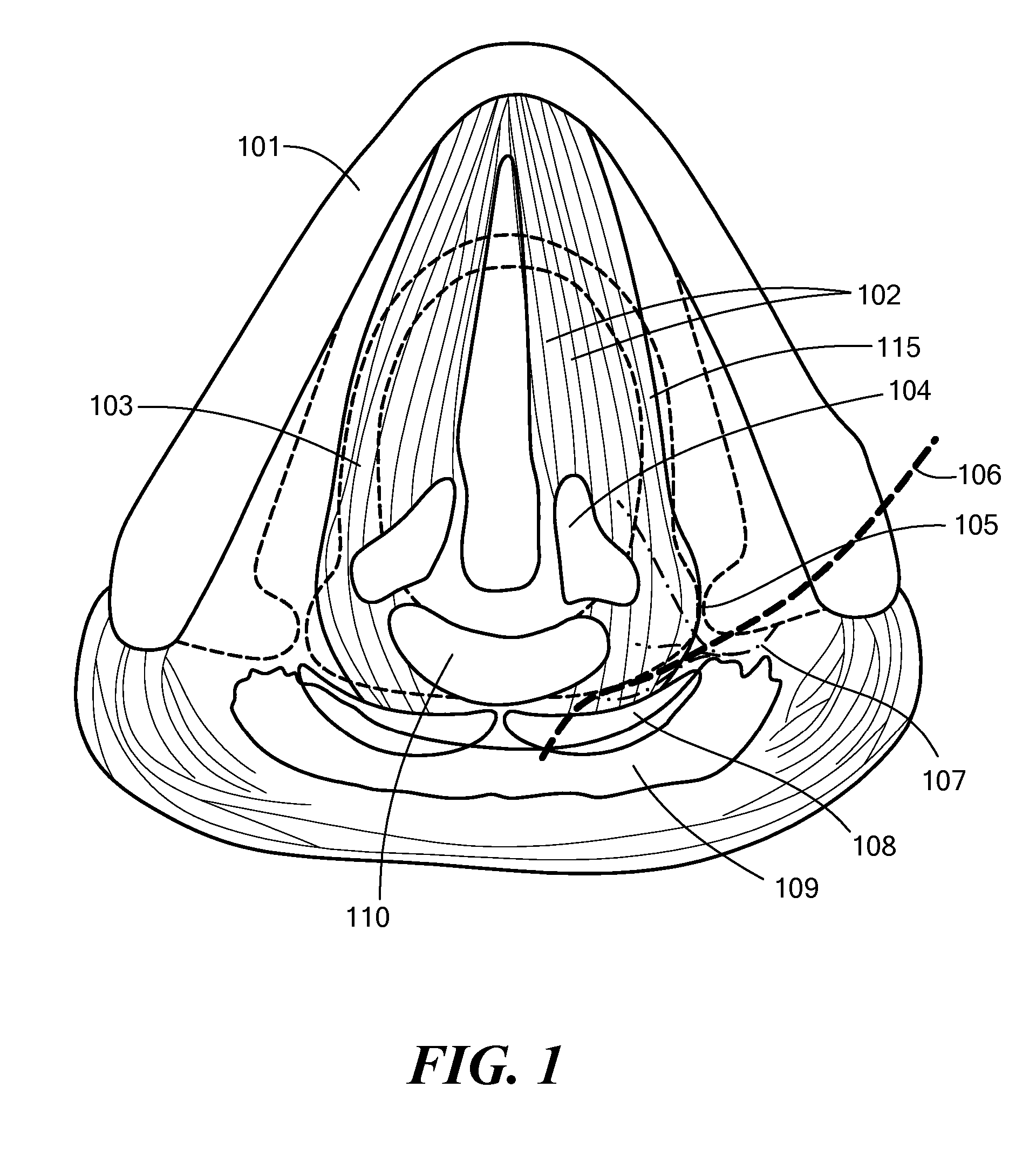 System, Apparatus, and Method for Facilitating Interface with Laryngeal Structures