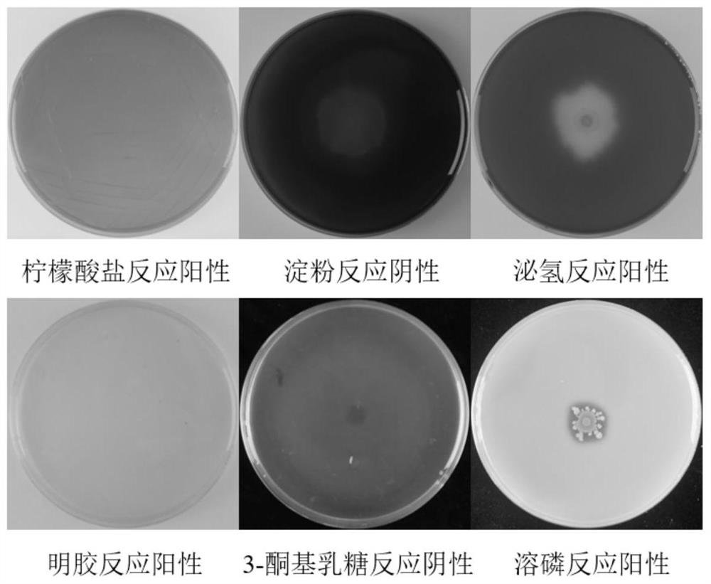 Root nodule endophyte S43 with phosphate solubilizing function and application of root nodule endophyte S43