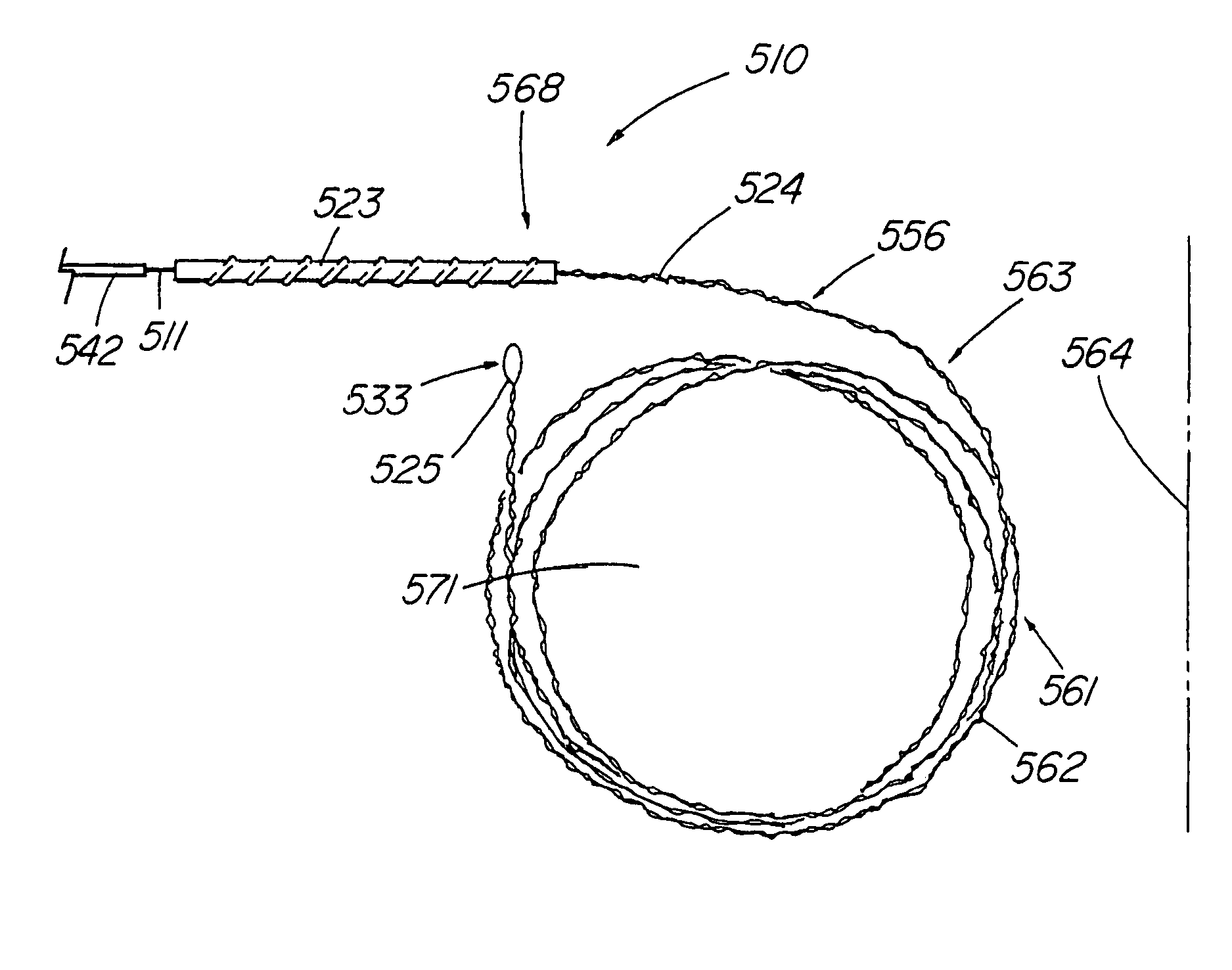 Method of removing an elongated structure implanted in biological tissue