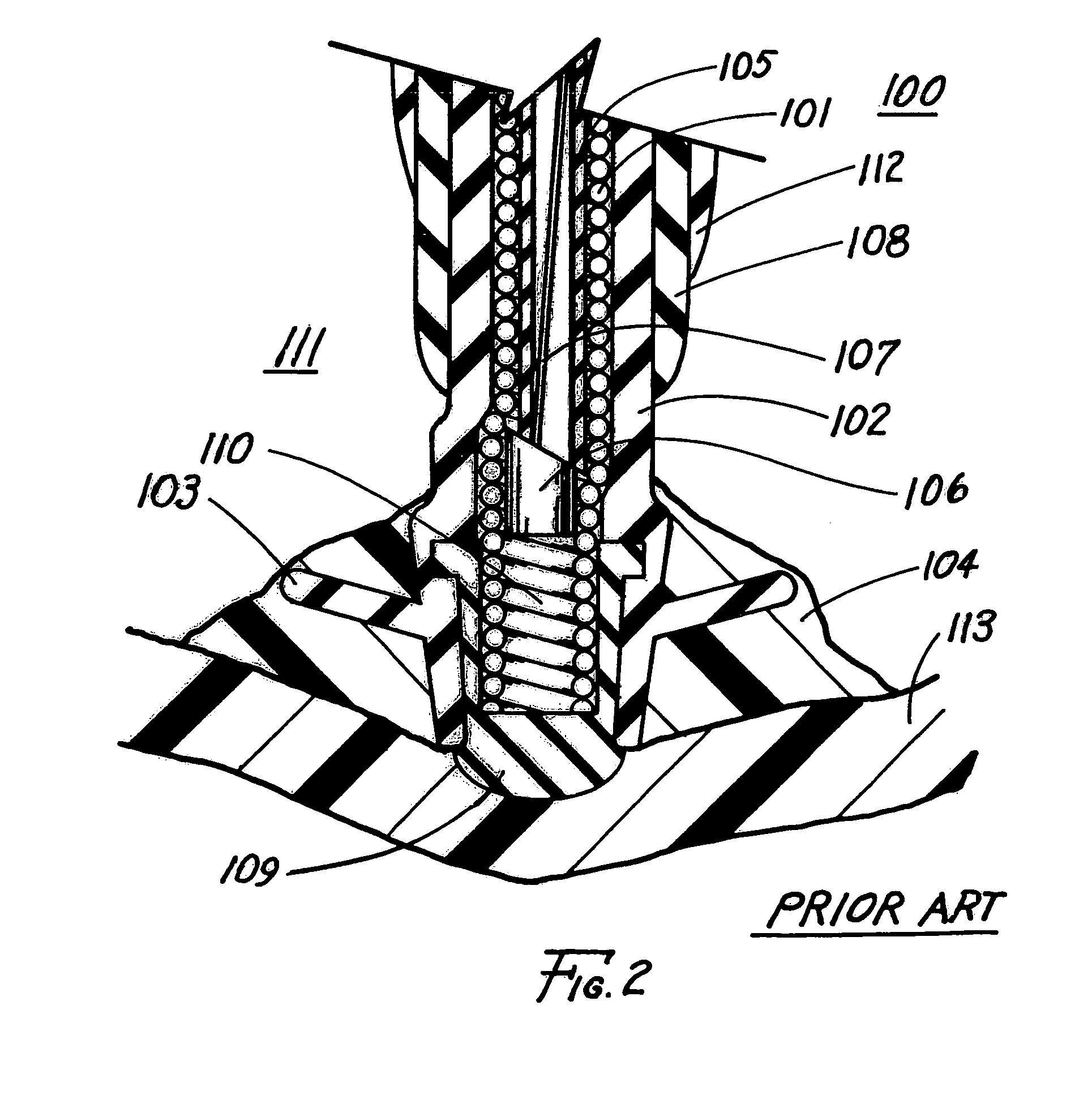 Method of removing an elongated structure implanted in biological tissue