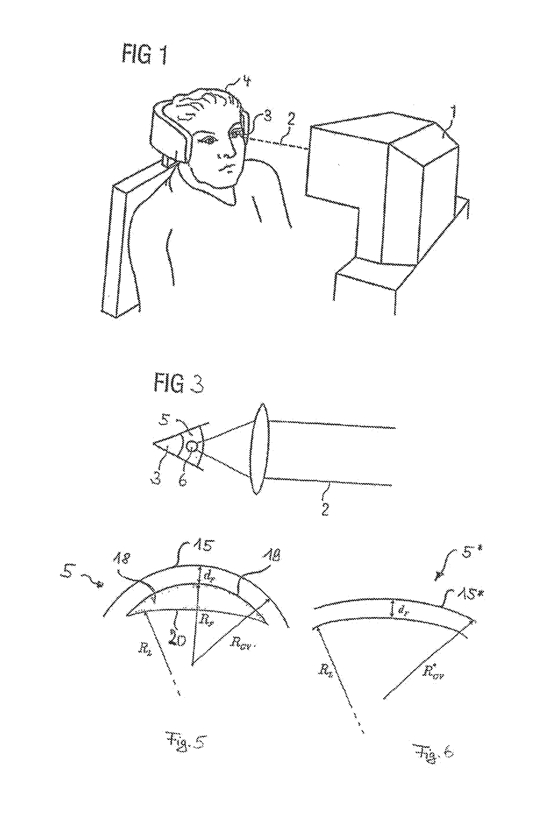 Device and method for producing control data for the surgical correction of defective eye vision