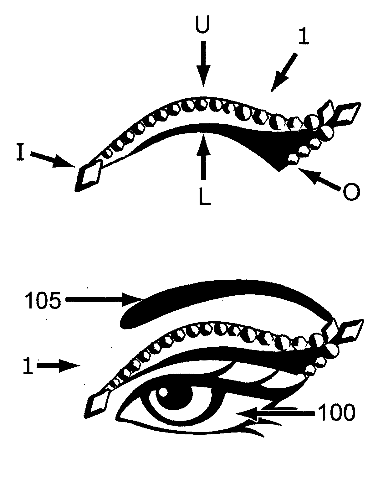 Decorative eyelid covering and process