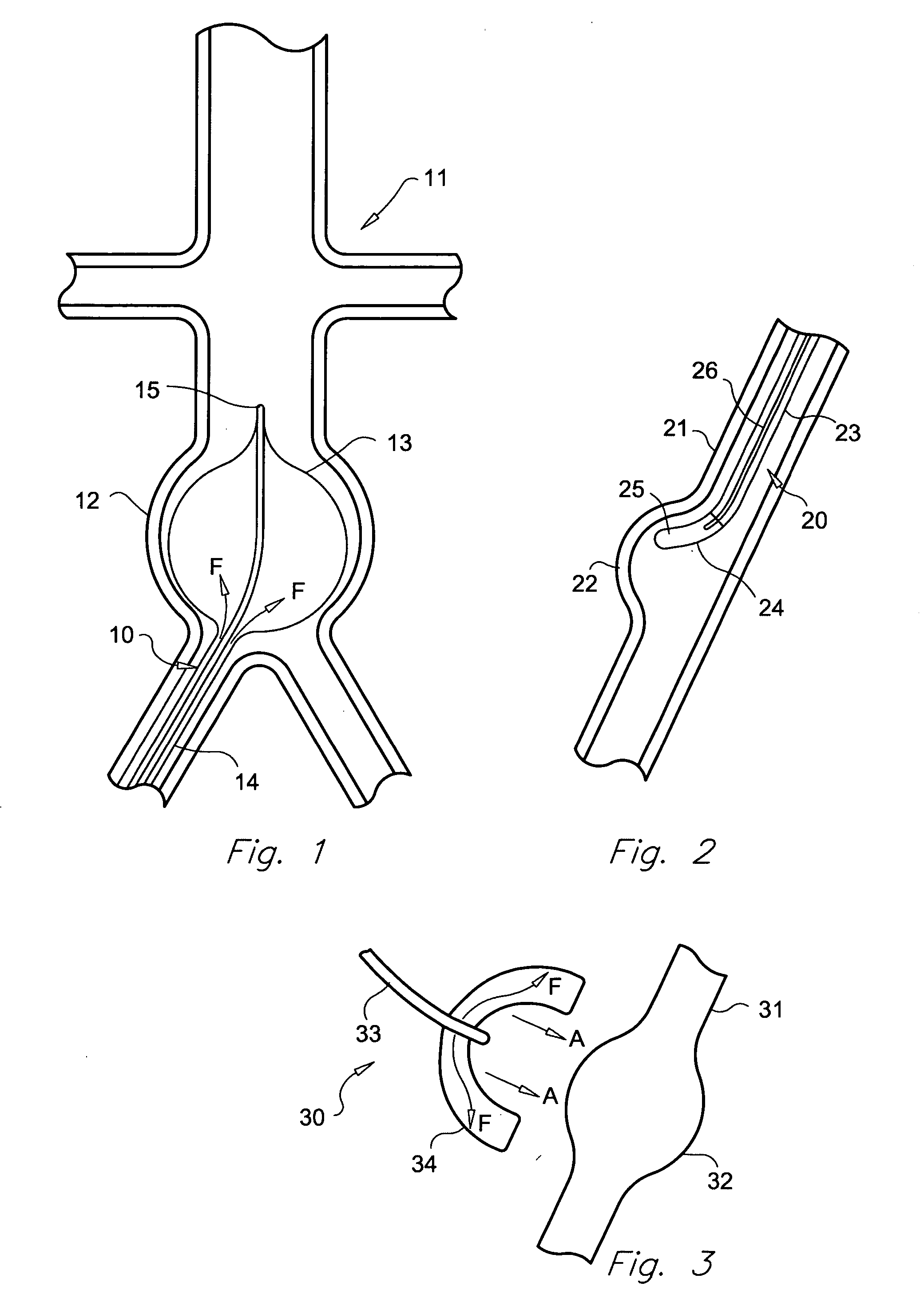 Method for treatment of aneurysms
