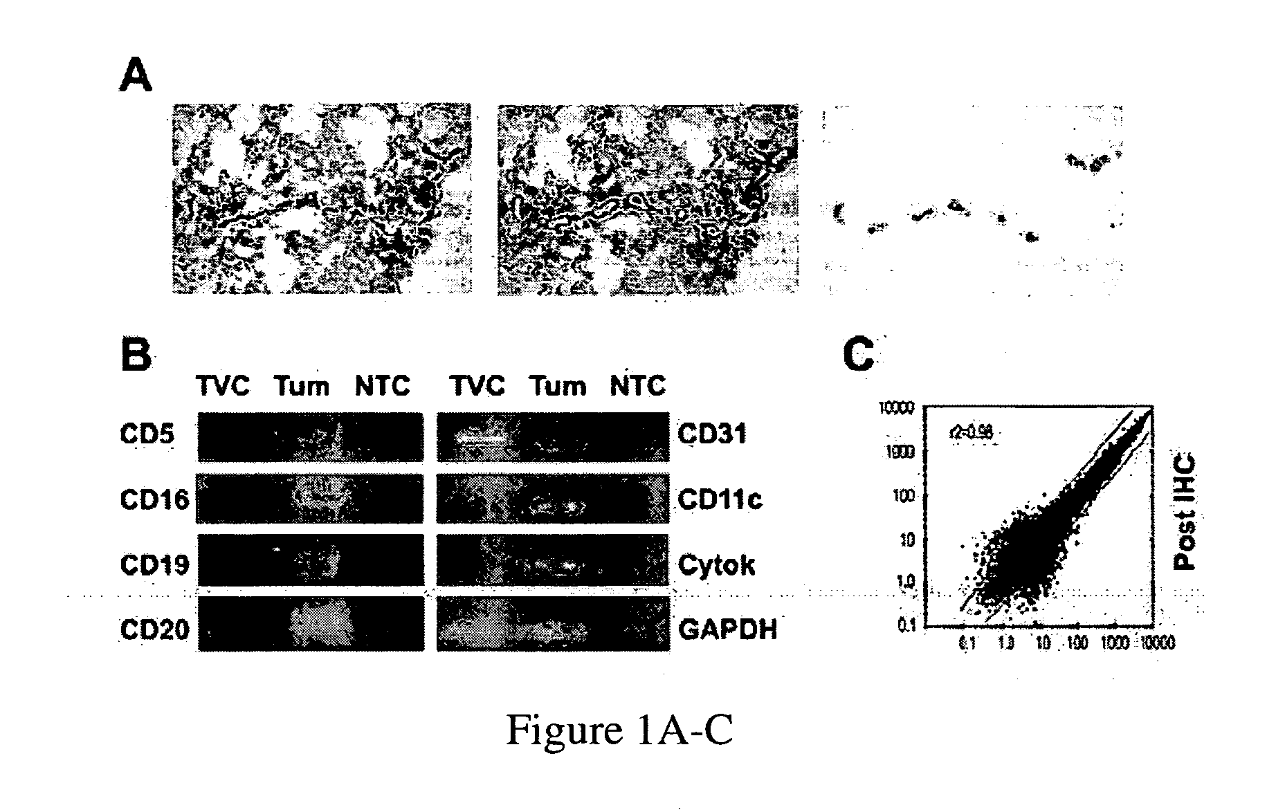 Tumor vasculature markers and methods of use thereof