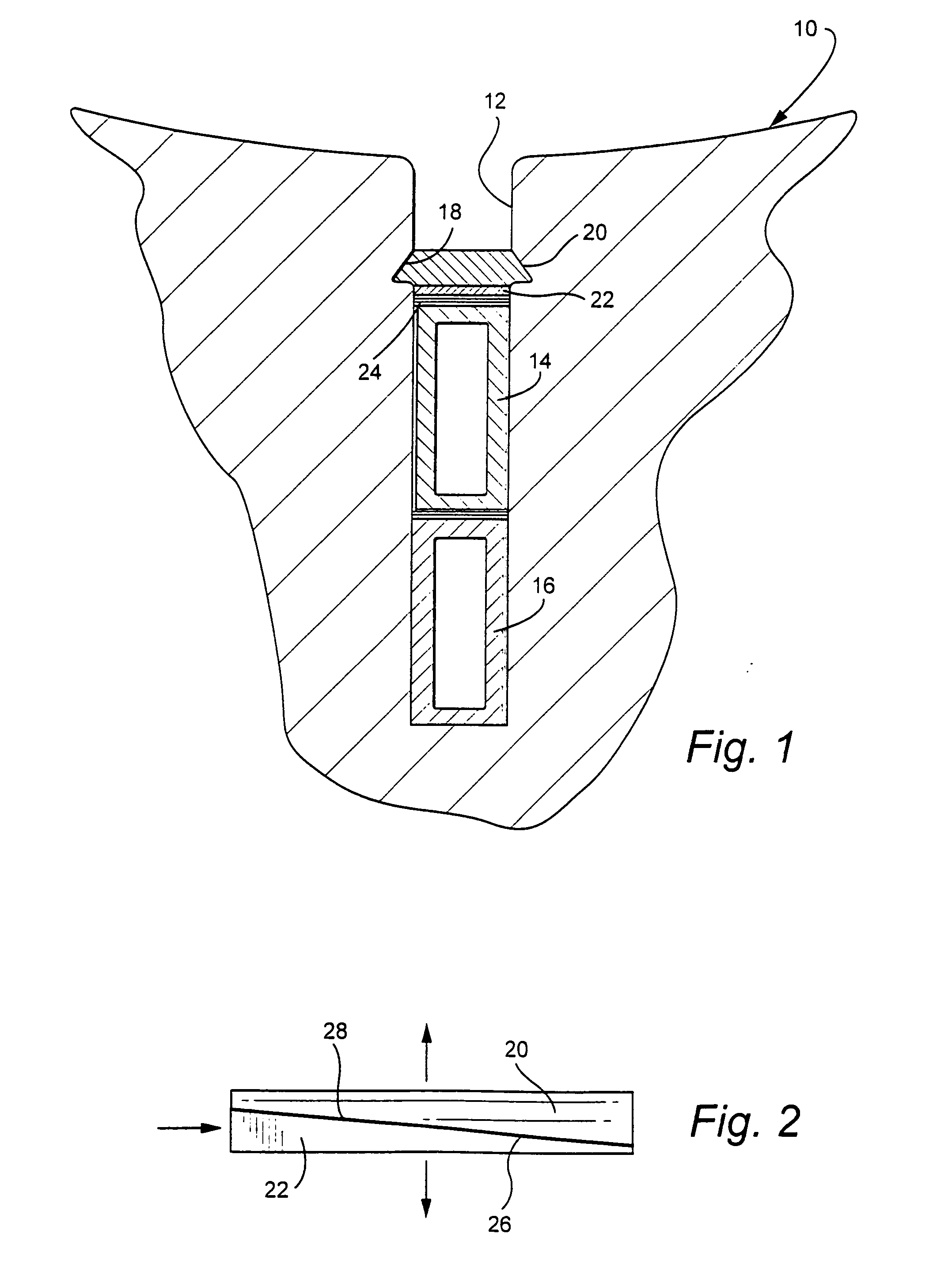 Re-tightenable stator body wedge system