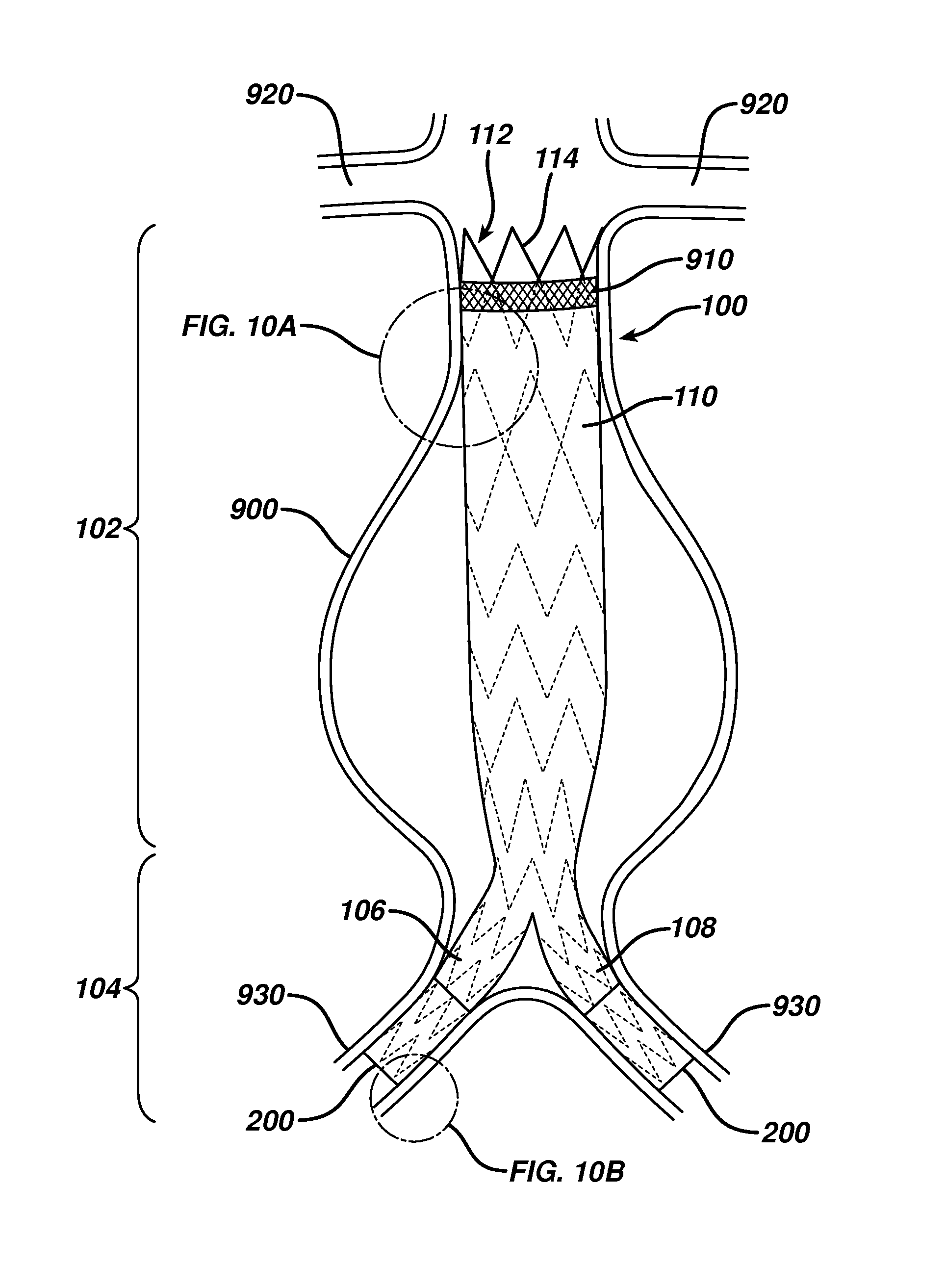 Sealing mechanism for expandable vascular device