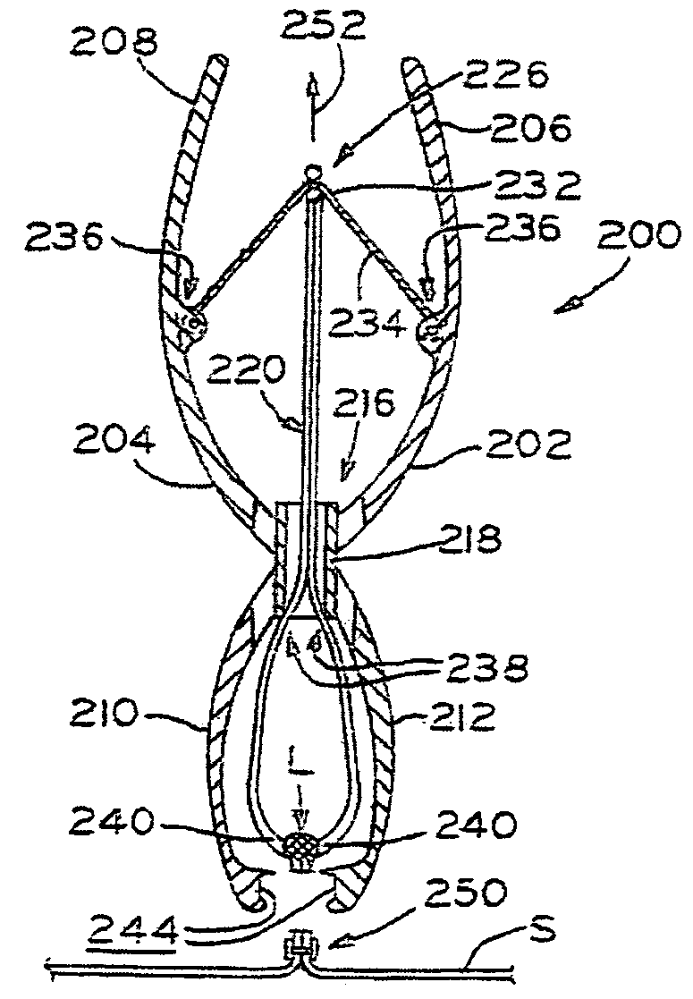 Skin lesion exciser and skin-closure device therefor