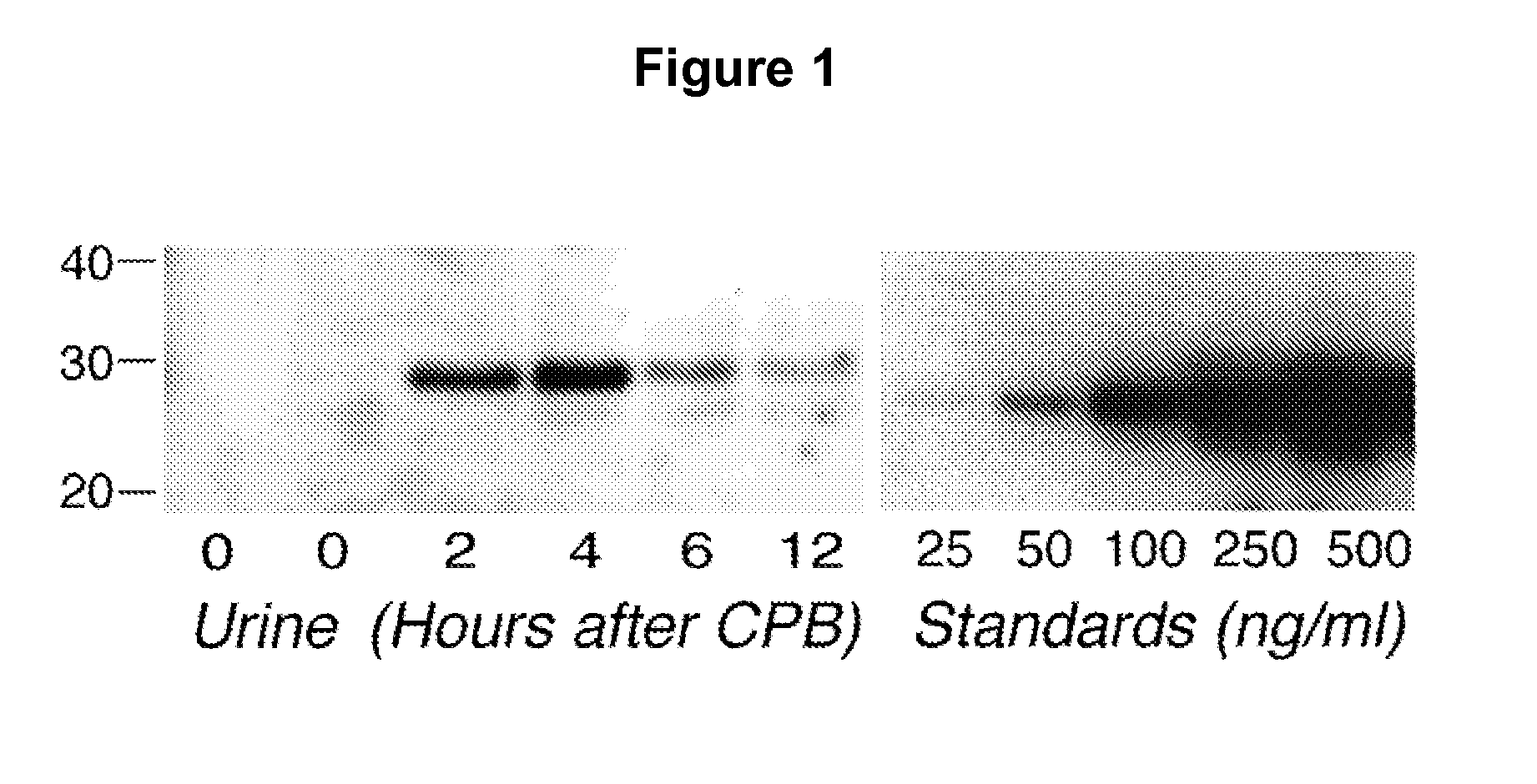 Method for the early detection of renal injury