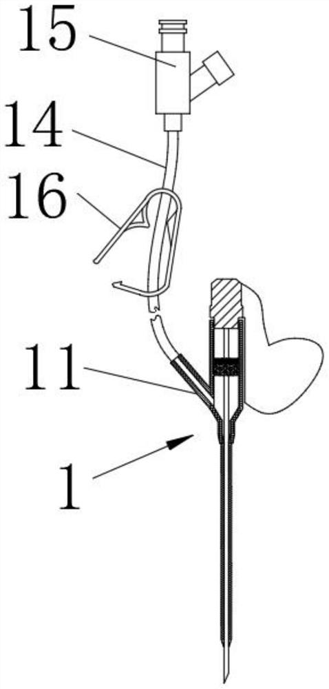 Abdominal cavity puncture catheterization drainage device