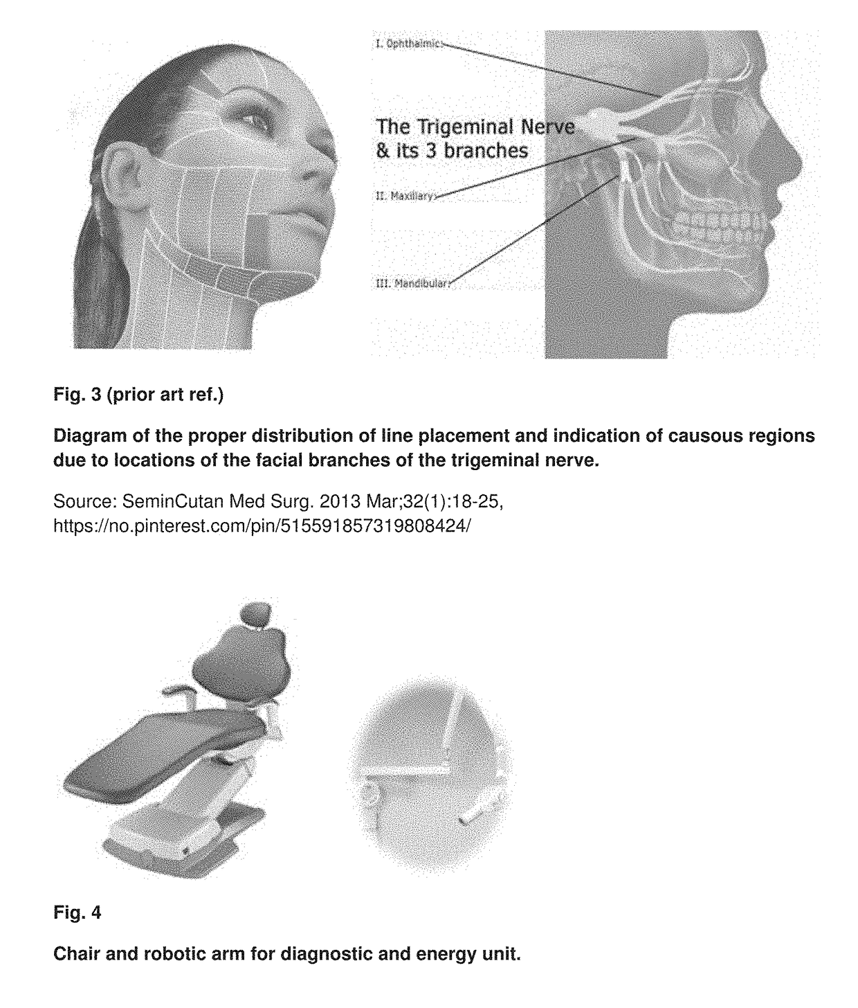 Non-invasive and optimized system for the rejuvenation and removal of wrinkles of the skin