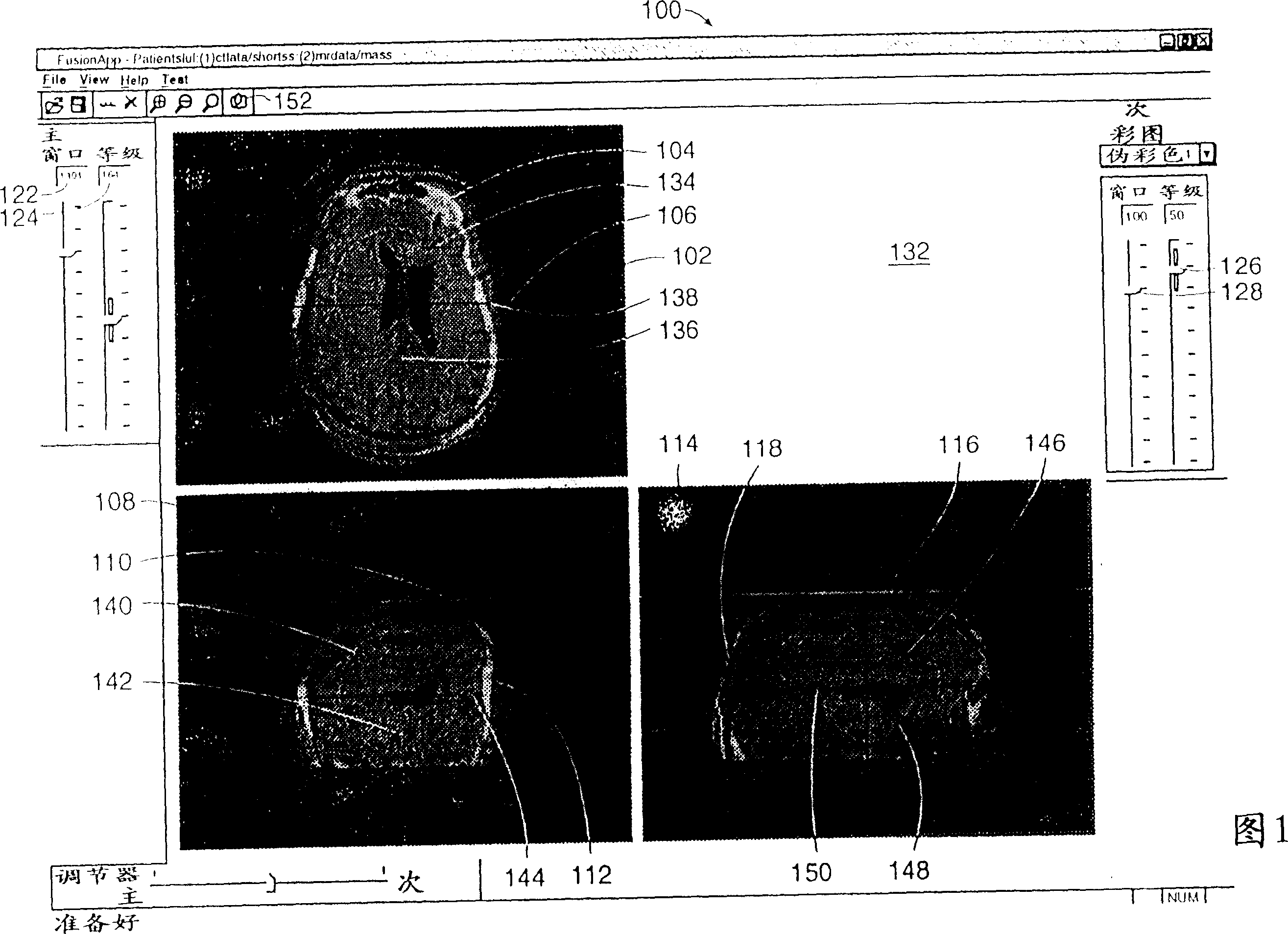 Automated image fusion/alignment system and method