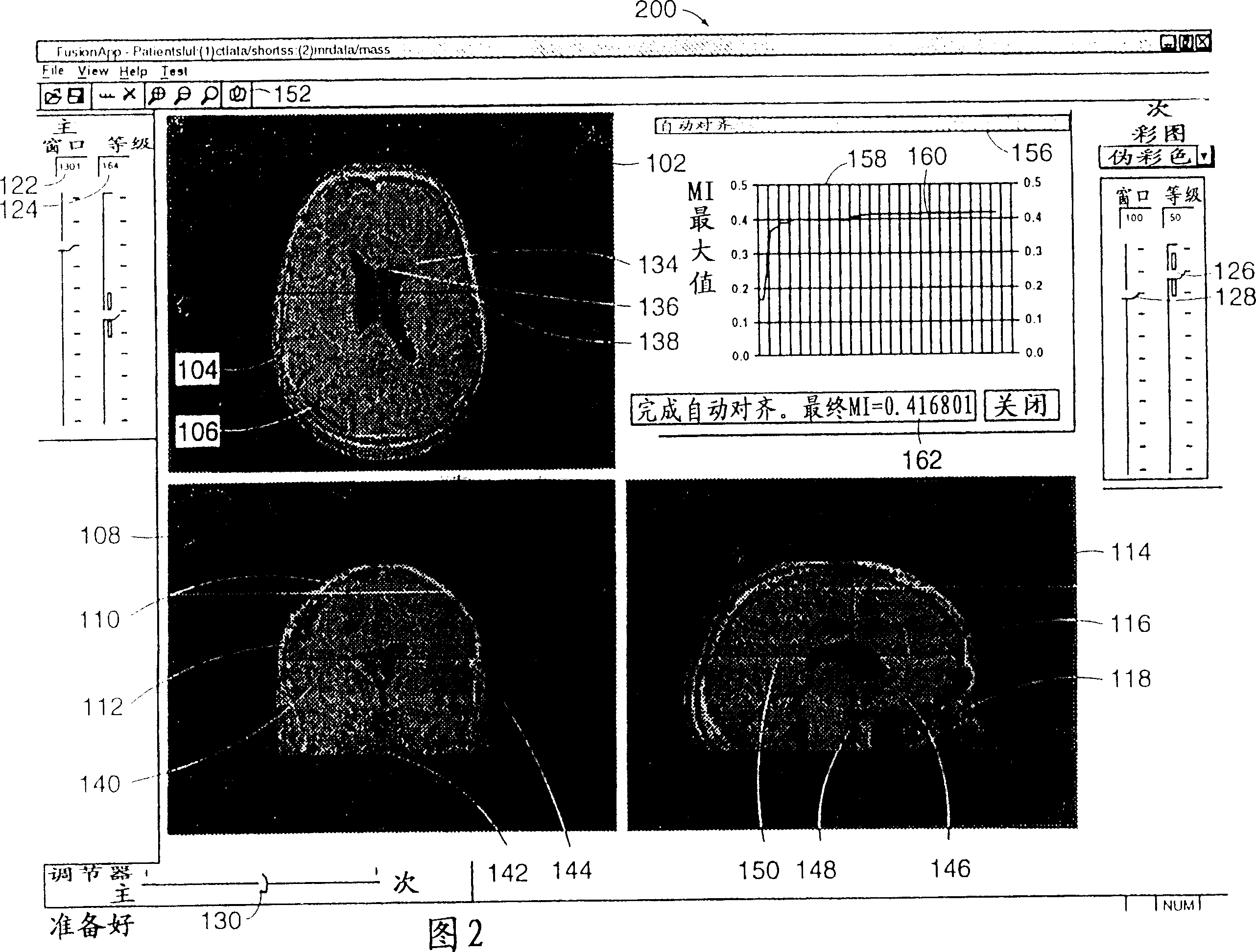 Automated image fusion/alignment system and method