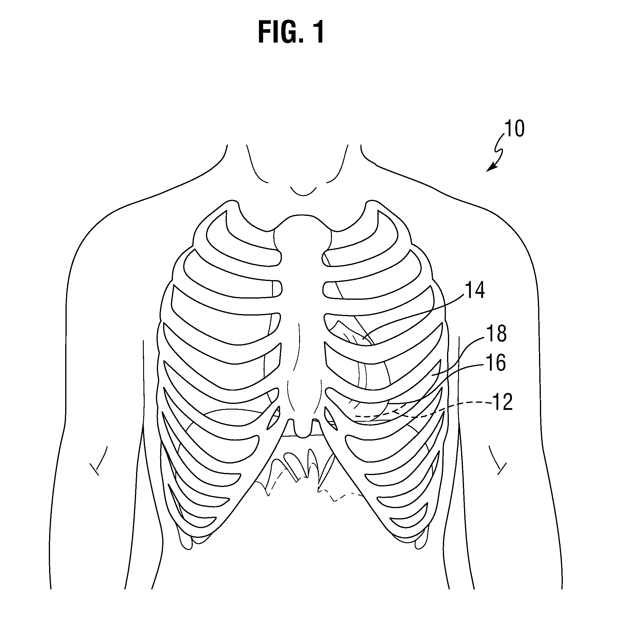 Surgical stabilizer and closure system