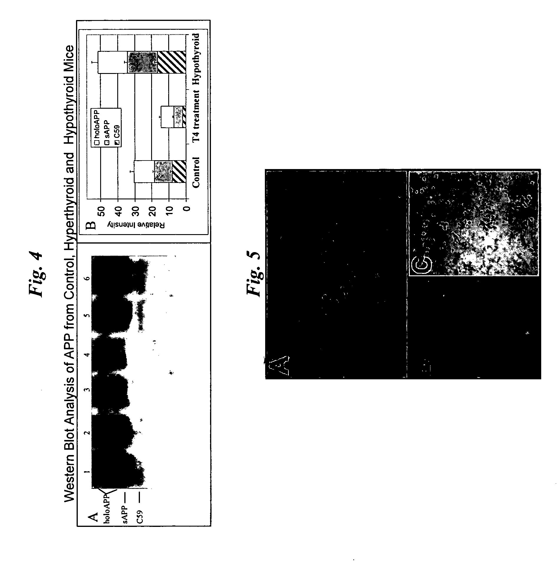 Compositions and methods for treating alzheimer's disease and dementia