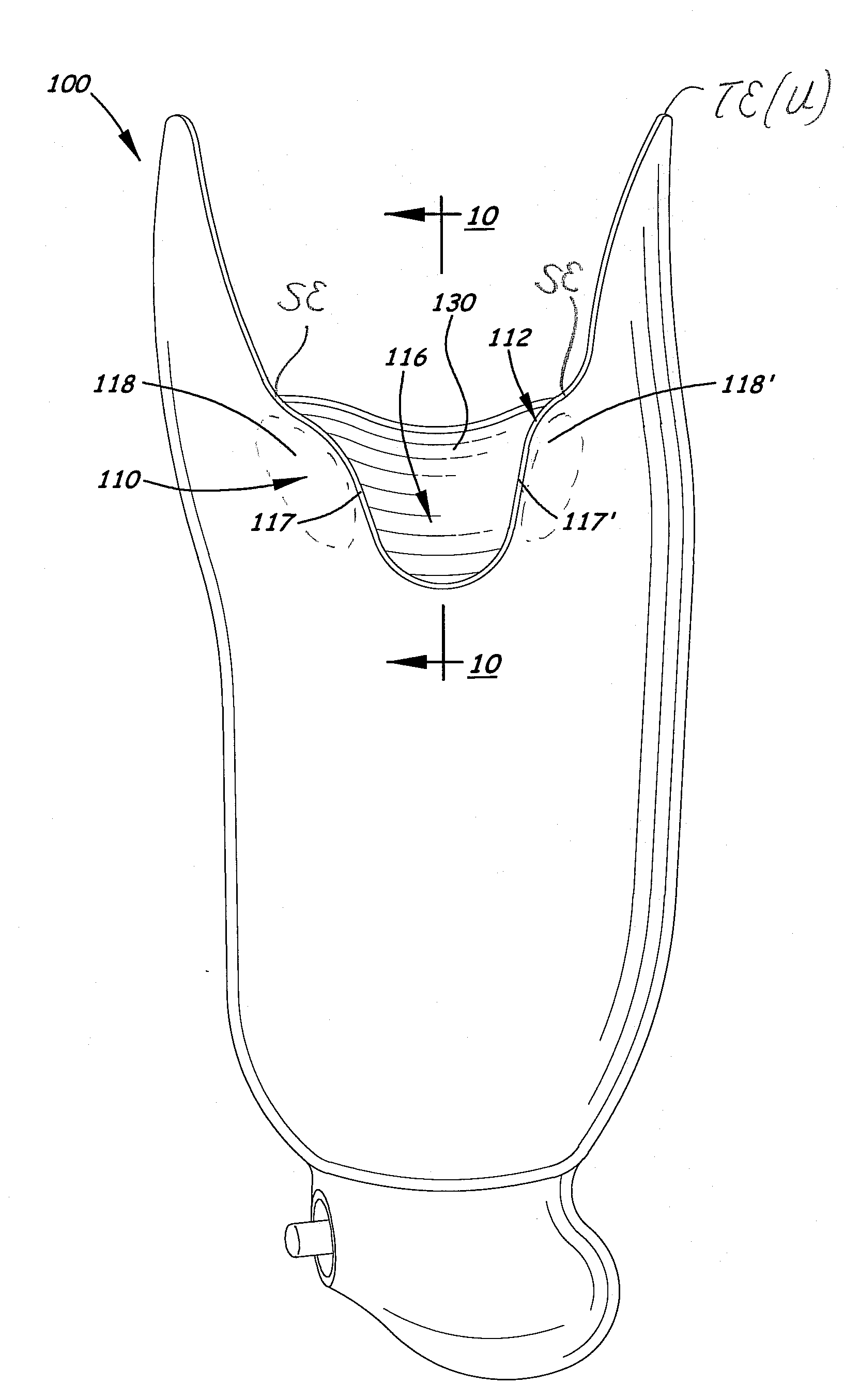 Transtibial socket for external prosthesis