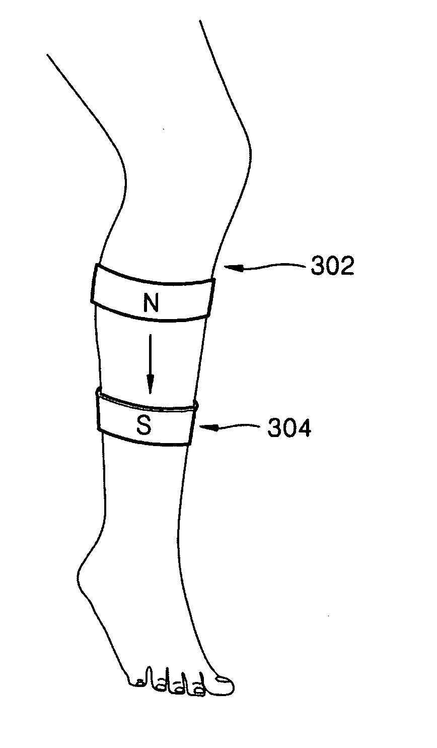 Apparatus and method for controlling blood circulation using a magnetic field