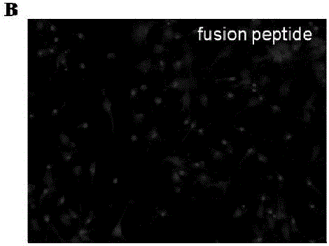 Fusion peptide TAT-MAS9C for destroying interaction between Mas receptors and PSD95