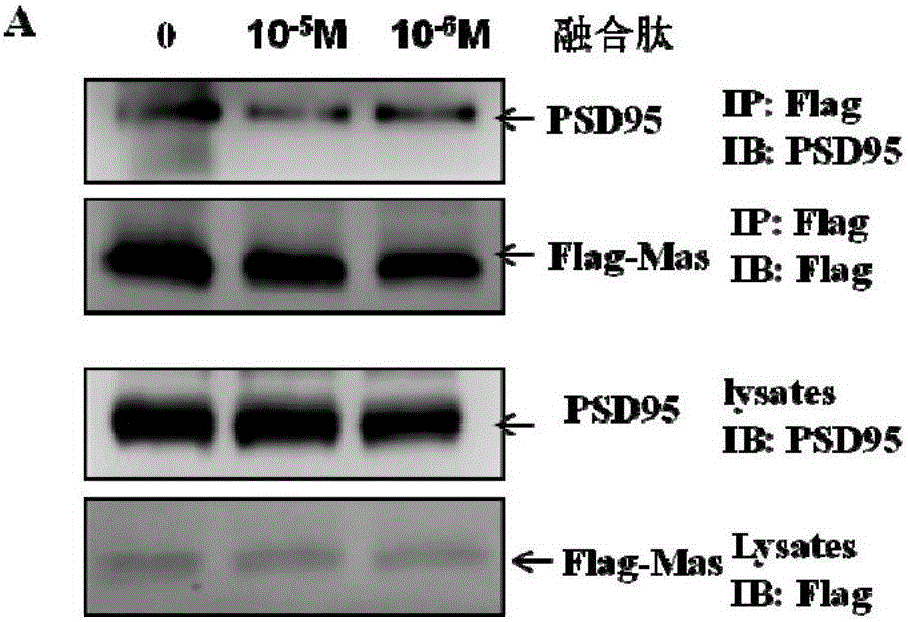 Fusion peptide TAT-MAS9C for destroying interaction between Mas receptors and PSD95
