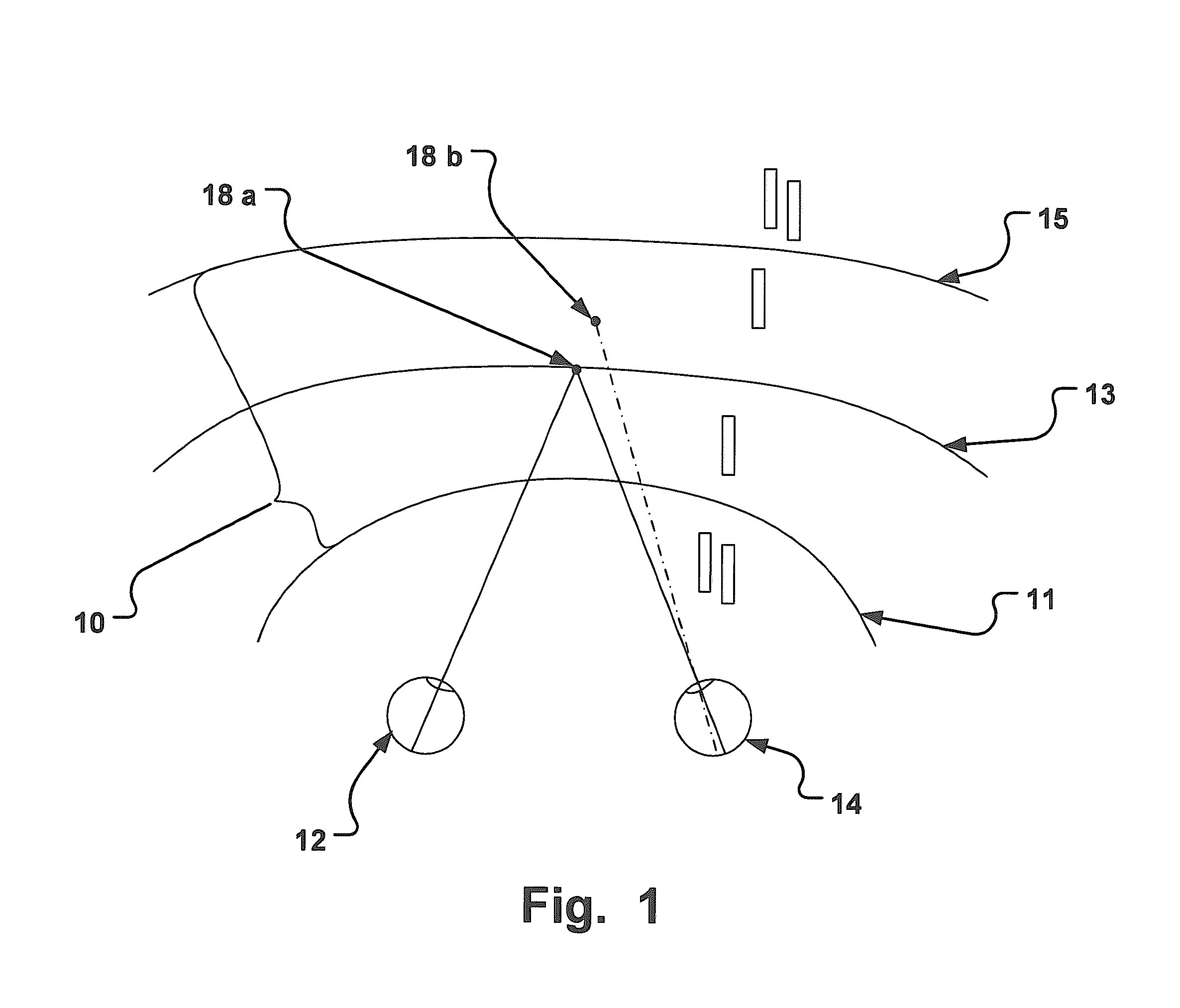 Apparatus and method for establishing and/or improving binocular vision
