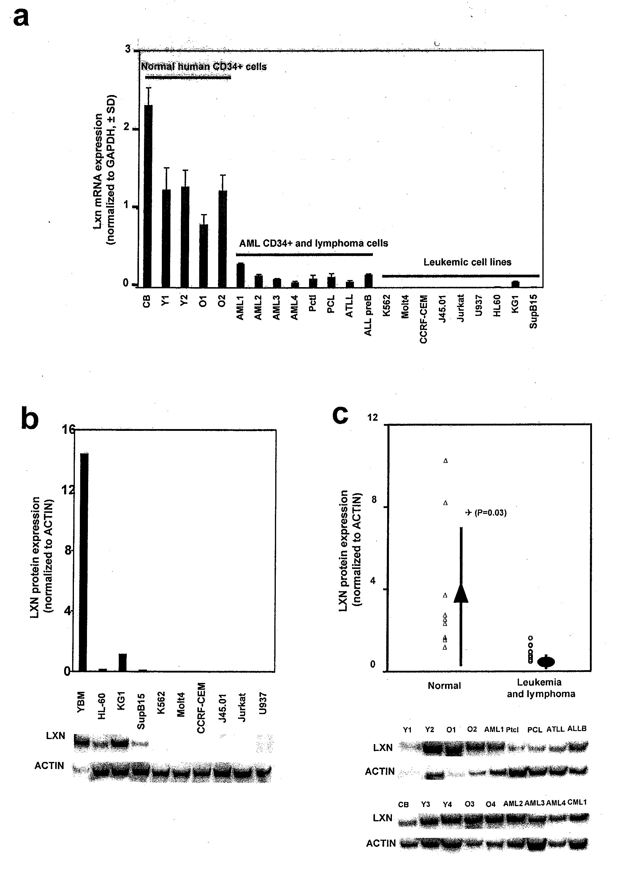 Methods and compositions for treating tumors and metastases through the modulation of latexin