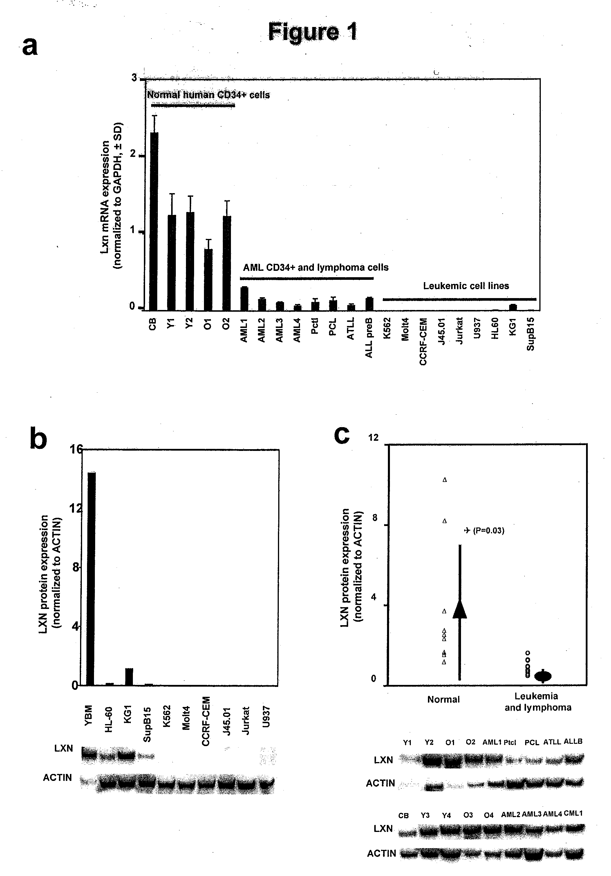 Methods and compositions for treating tumors and metastases through the modulation of latexin