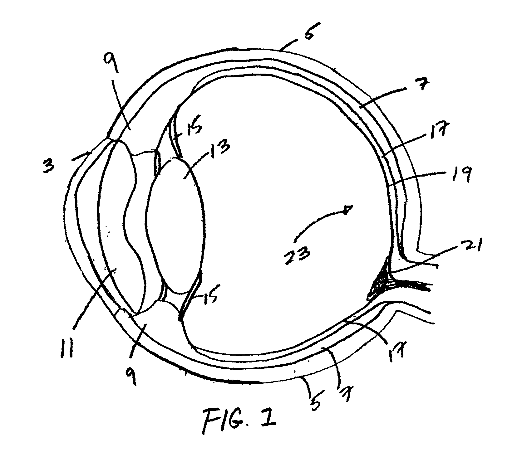 Method of treating the human eye with a wavefront sensor-based ophthalmic instrument