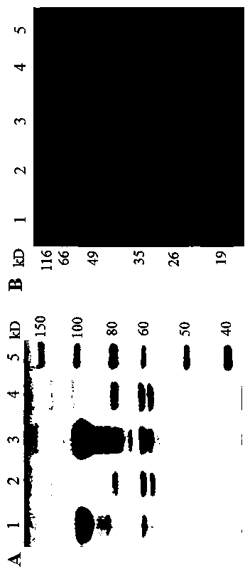 Human fibroblast growth factor 21 recombinant protein and its preparation method and application