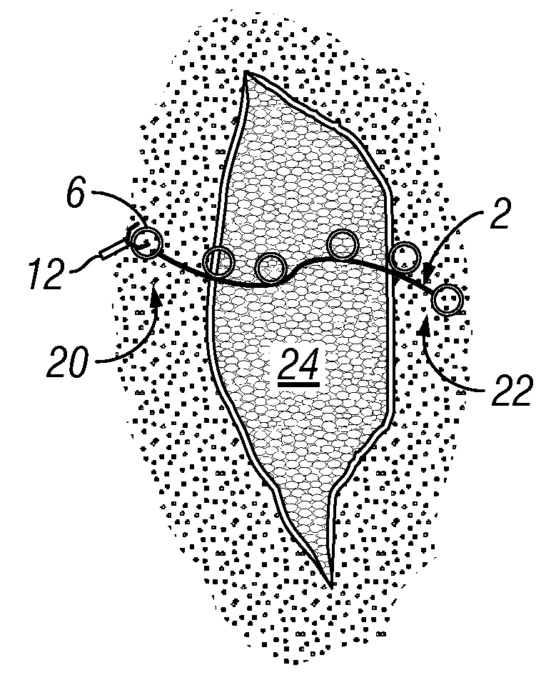 Tissue Approximator and Retractor Assistive Device