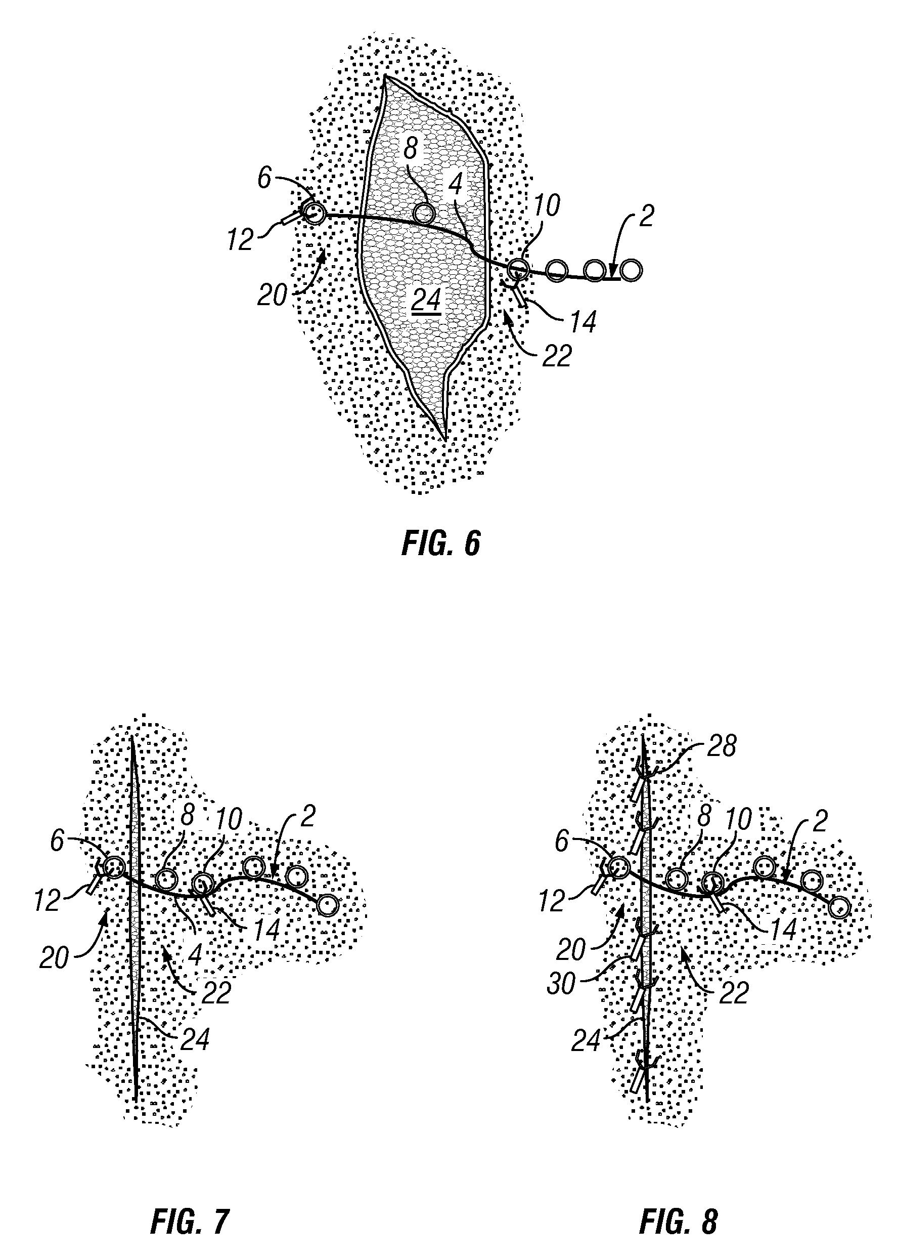 Tissue Approximator and Retractor Assistive Device