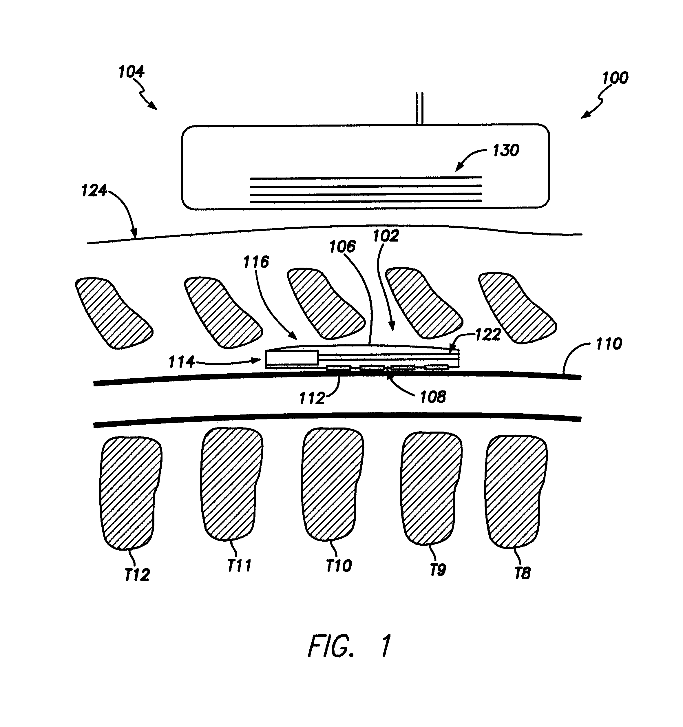 Leadless neurostimulation device and method including the same