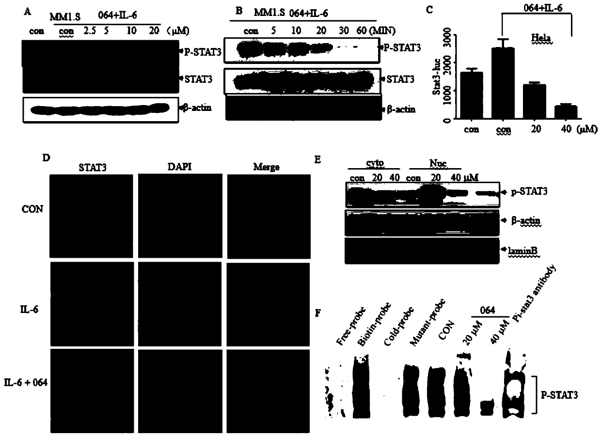 Application of sinomenine derivatives in the preparation of drugs for treating multiple myeloma