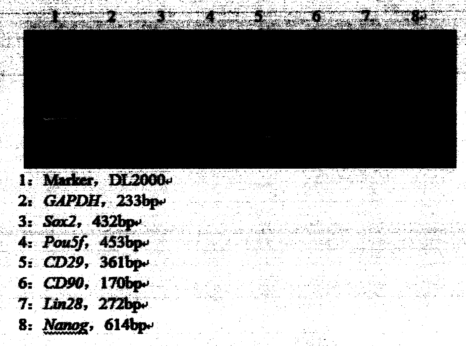 Preparation method for stem cell preparation capable of preventing and treating mycoplasma pneumoniae of swine