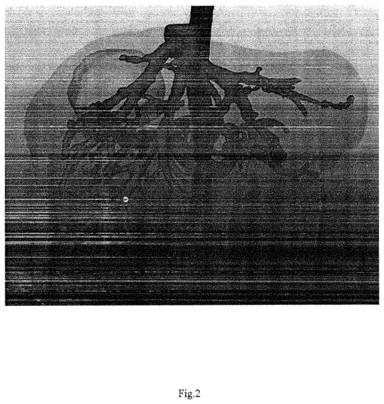 System and method for interactive three dimensional operation guidance system for soft organs based on anatomic map and tracking surgical instrument